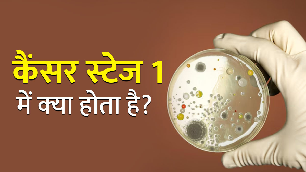 कैंसर स्‍टेज 1 में शरीर के भीतर क्‍या होता है? डॉक्‍टर से जानें लक्षण, डायग्नोसिस और इसका प्रभाव